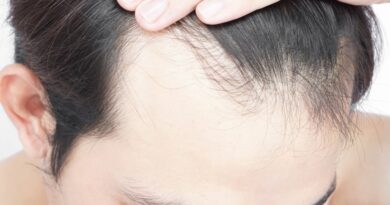 Hair Loss Treatments for Men